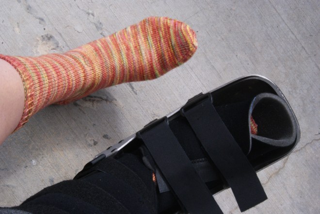 Sock Modeling with a broken foot